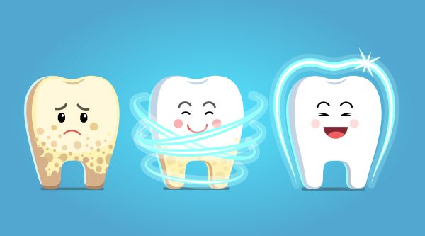 Gentle Teeth Whitening