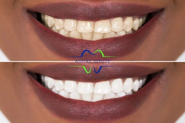Side-by-side comparison showing before and after results of a cosmetic treatment Gloucester
