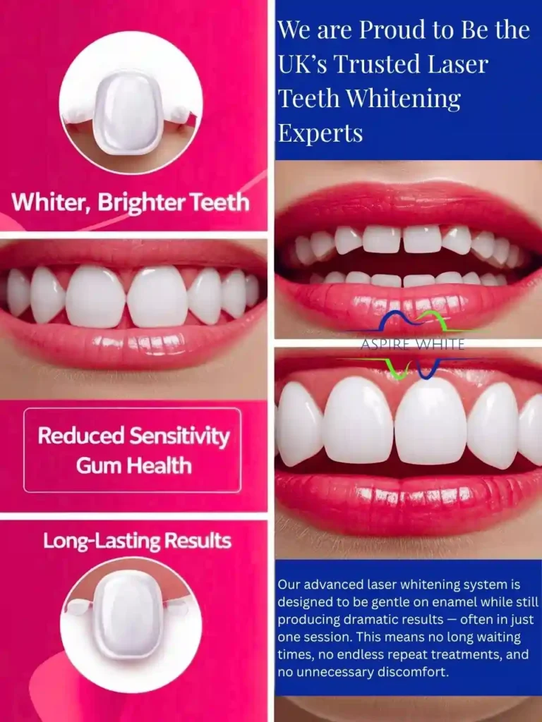 We are Proud to Be the UK’s Trusted Laser Teeth Whitening Experts Gloucester